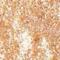 Revolution Relove Eye Light Metallic Eyeshadow Течни сенки за очи металик за жени 1,9 ml